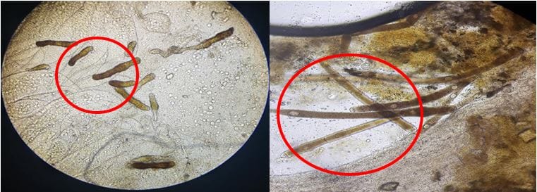 TÔM BỊ NỘI NGOẠI KÝ SINH TRÙNG, GÂY XOẮN RUỘT, MỦ ĐUÔI